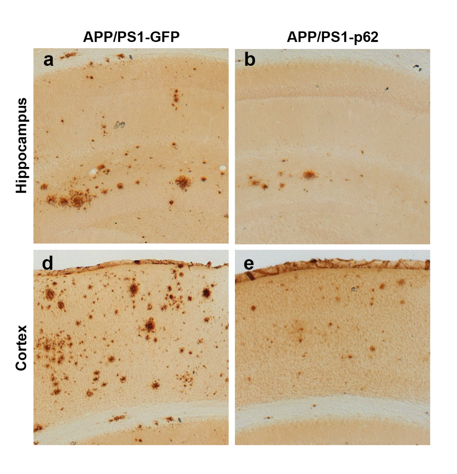 Reducing amyloid beta protein in the brain