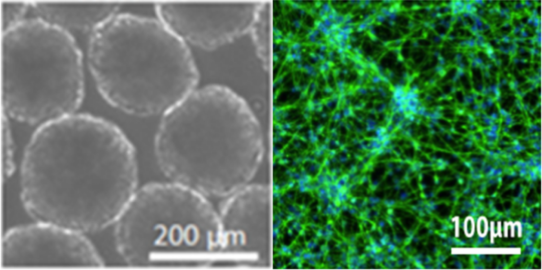 Picture of brain organoids and neurons