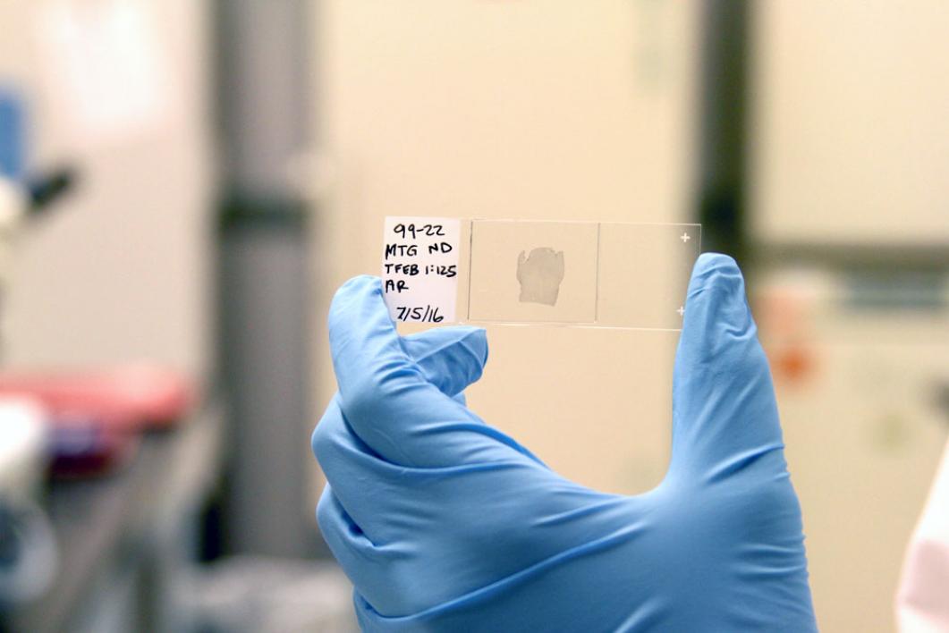 person holding slide with tissue on it