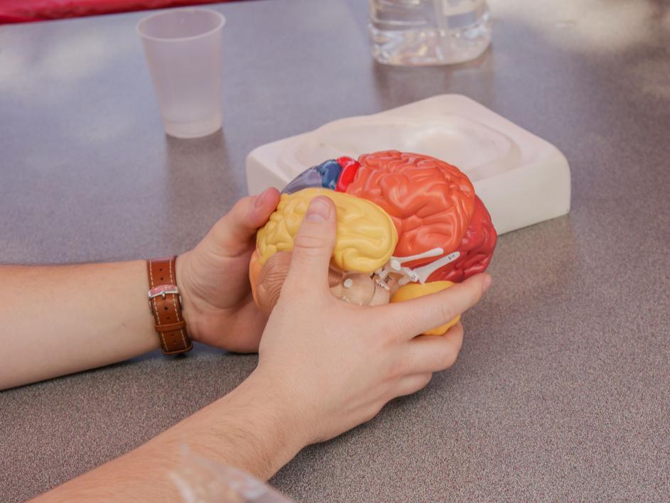 Steven Northrup-Smith holds a model of a brain