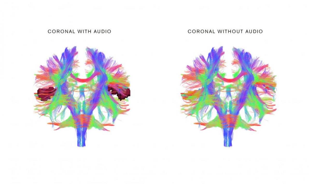 Your Brain on Music