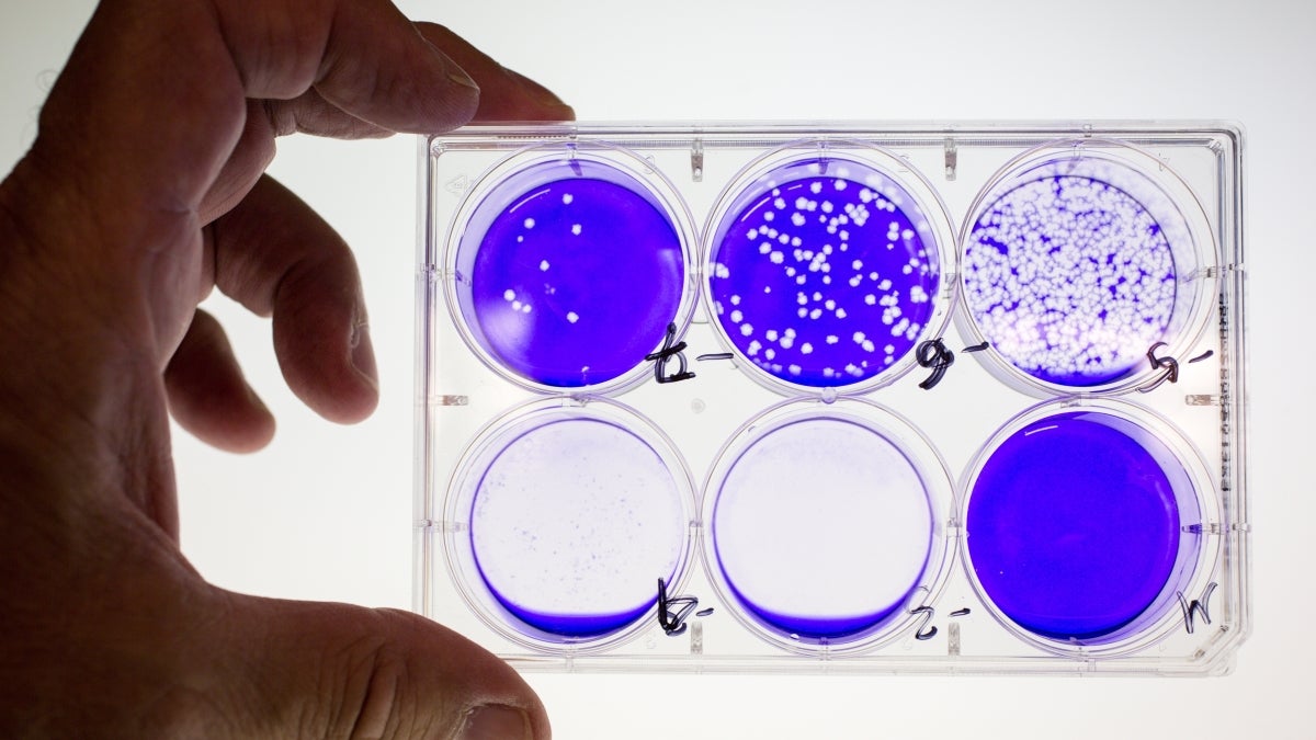 Stained culture dishes holding viruses and cells in a lab.