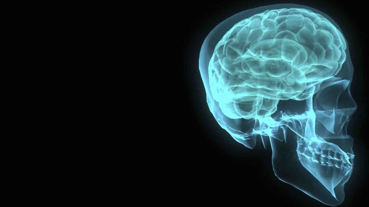 A human brain and skull are shown in an X-ray