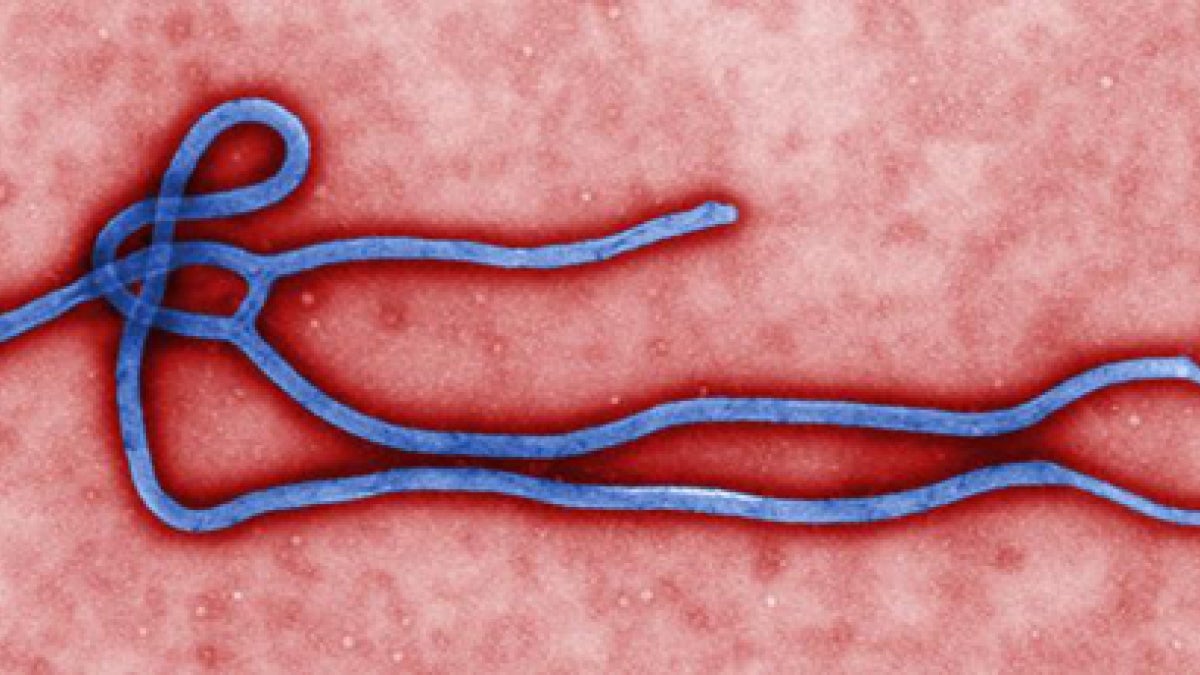 Ebola virus