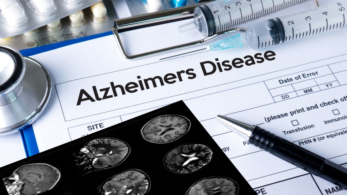 Stock photo of Alzheimer's chart with brain scans and medication