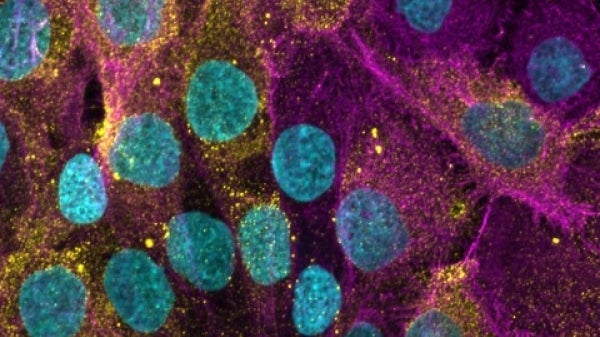 Image of skin cells and histamine up close