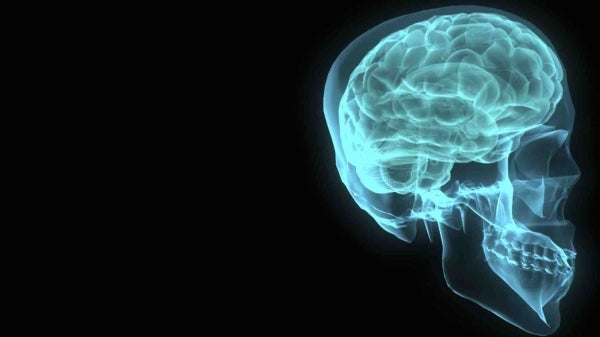 A human brain and skull are shown in an X-ray