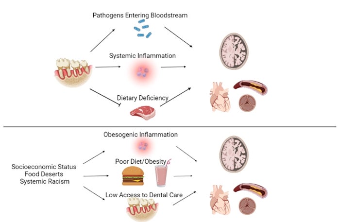 Conceptual pathways oral health,heart and brain