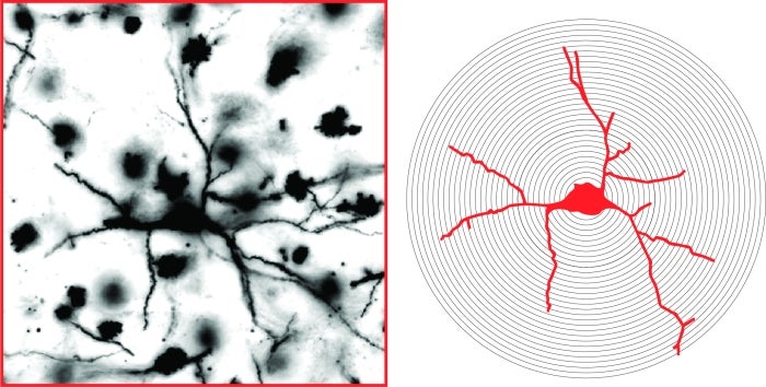 Golgi-Cox stained neuron.