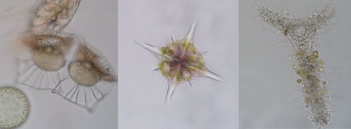 Three images of radiolarians under a microscope