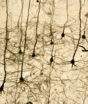 Brain neurons.